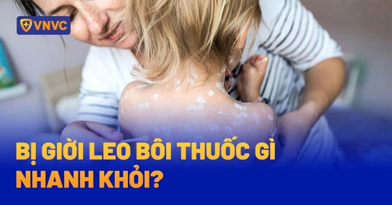 bị giời leo bôi thuốc gì