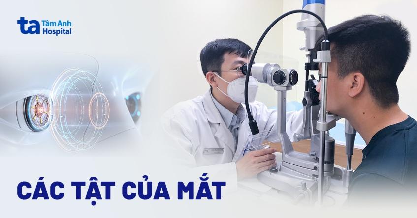 các tật của mắt